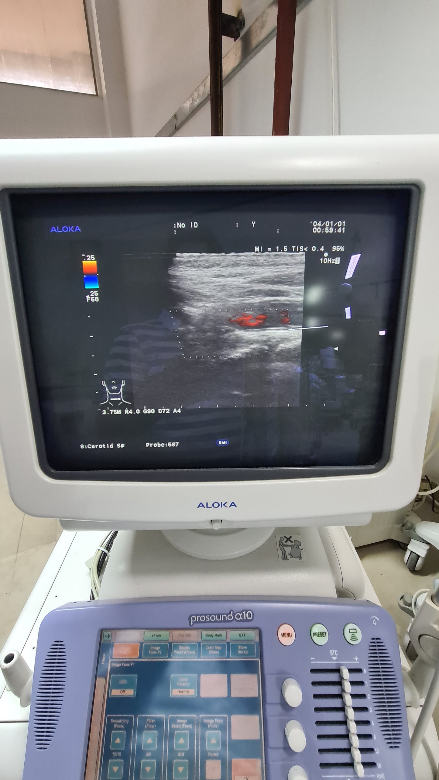 Z..Aloka UST 5413 linear Probe checked dxb