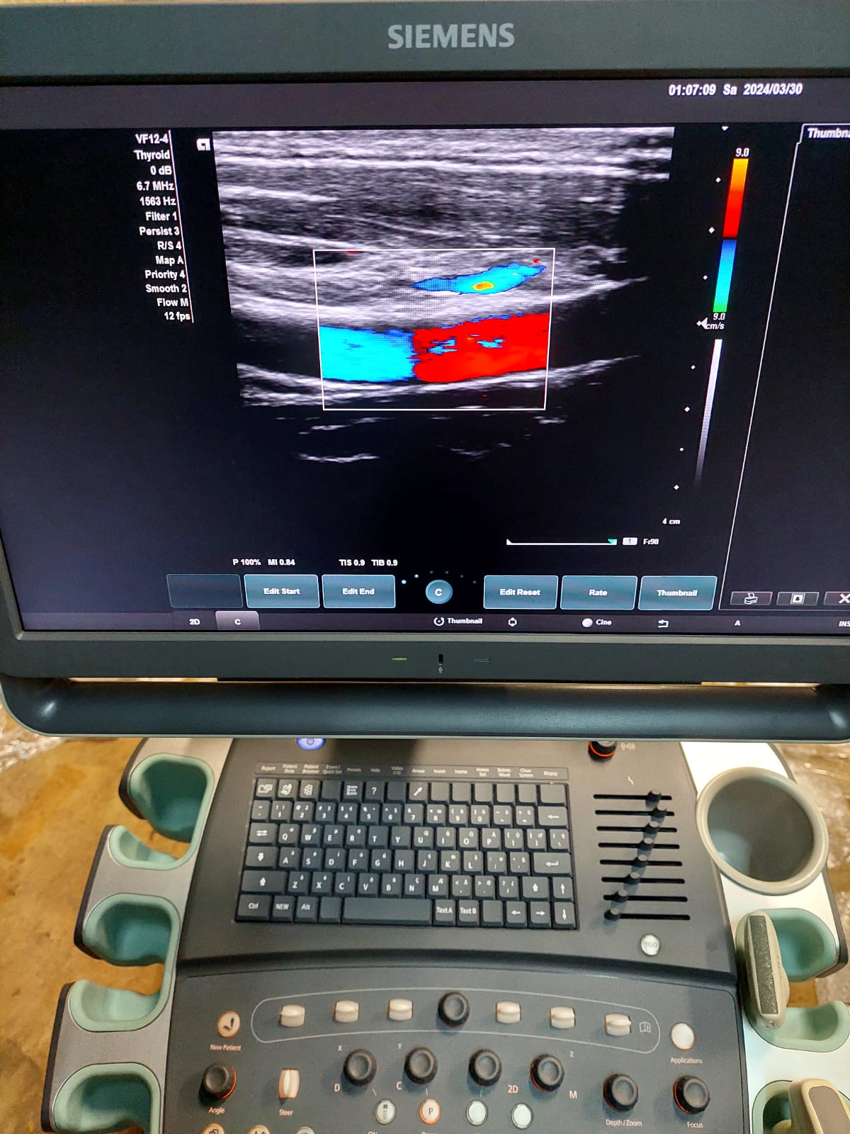 Siemens Acuson X700 with convex And Linear Probes - Japan Medical Company LTD