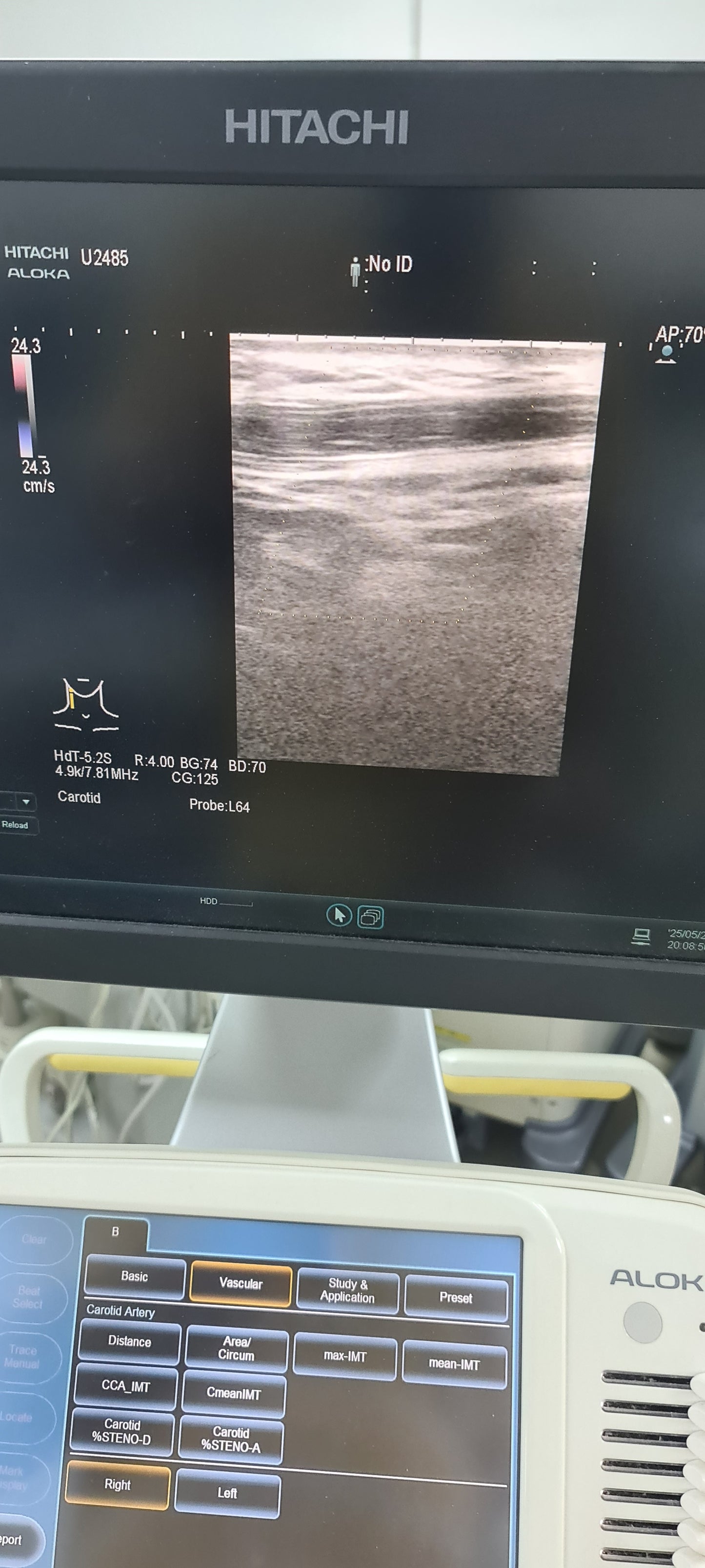 Hitachi 18-5 IPX7 Probe Checked SN: KE10750308A dxb