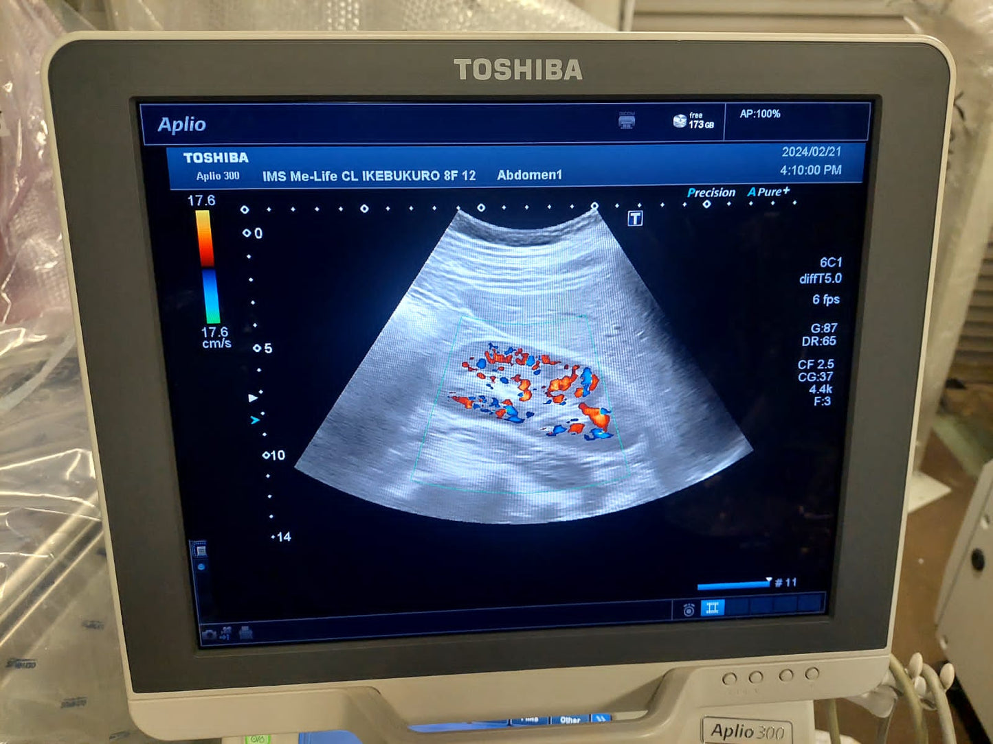 Toshiba Aplio 300 with convex(PVT-375BT), PLT(704AT), PLT(805AT) probes. - Japan Medical Company LTD