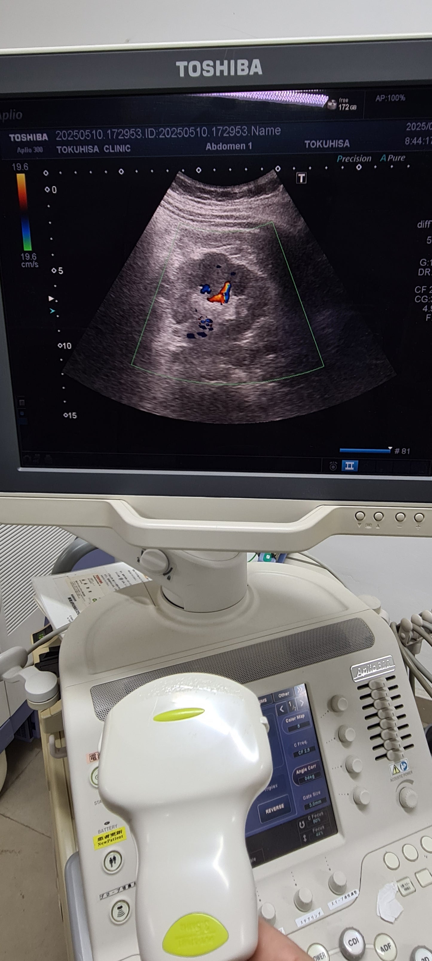 Toshiba 6C1 Convex Prob  Checked SN: FDA1262270 dxb