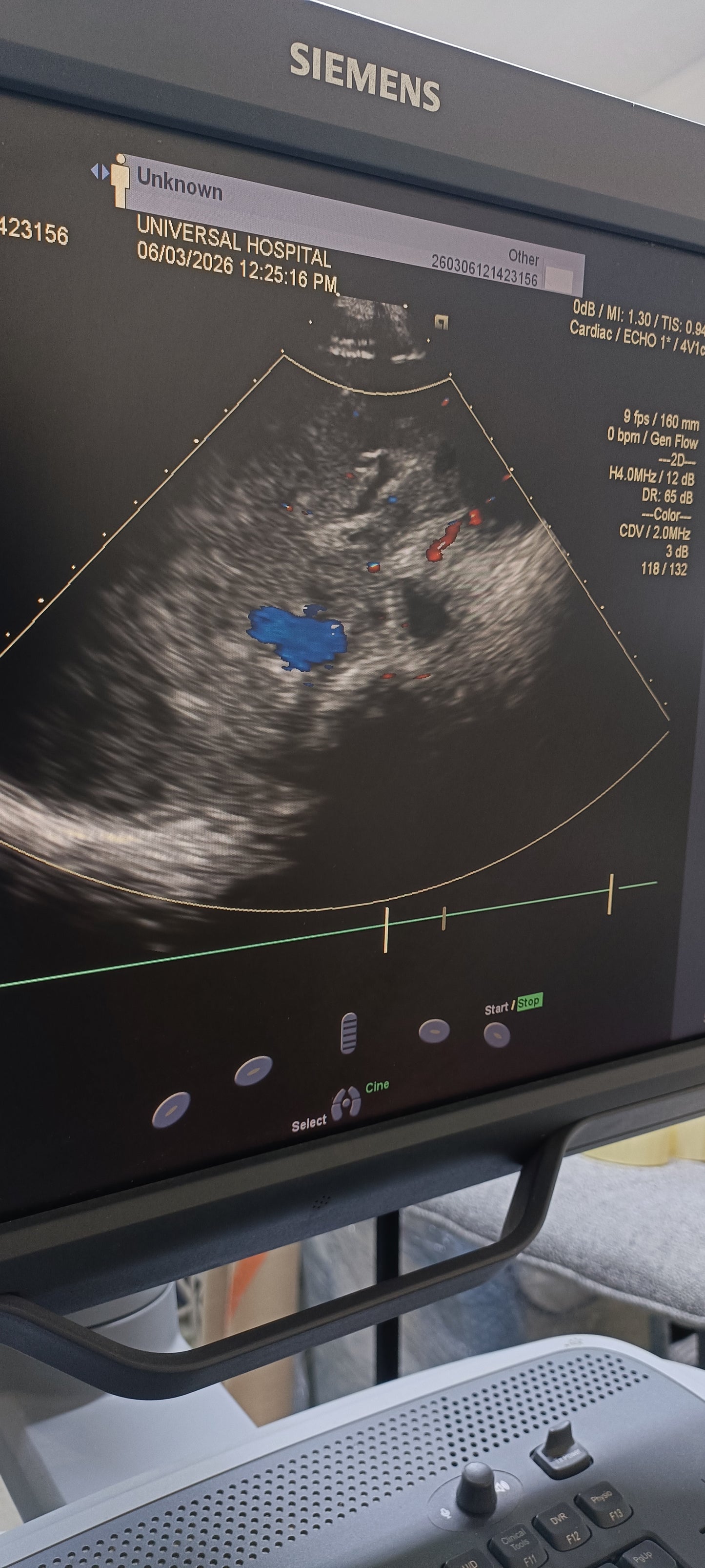 Siemens cardiac probe sn. 00485607 moy. 2010 checked dxb IS (MW) - Japan Medical Company LTD