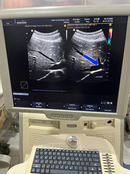 Samsung medison c2-6ic sn. B17914310029082 checked dxb