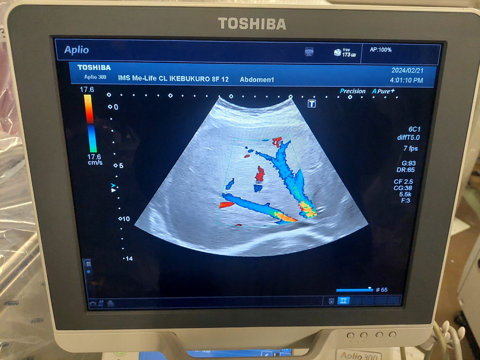 Toshiba Aplio 300 with convex(PVT-375BT), PLT(704AT), PLT(805AT) probes. - Japan Medical Company LTD