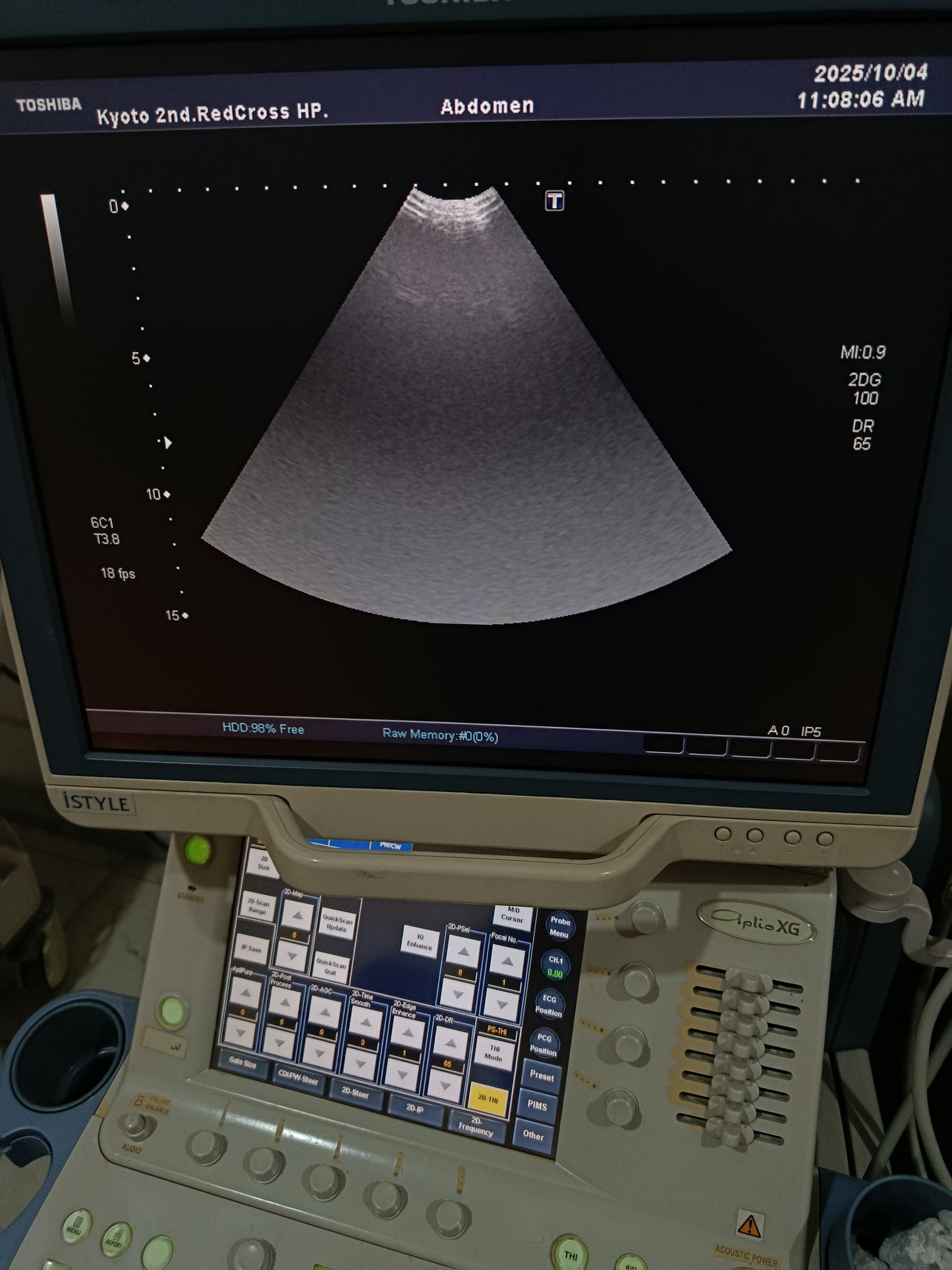 P..Toshiba PVT-382BT Cardiac Probe UC