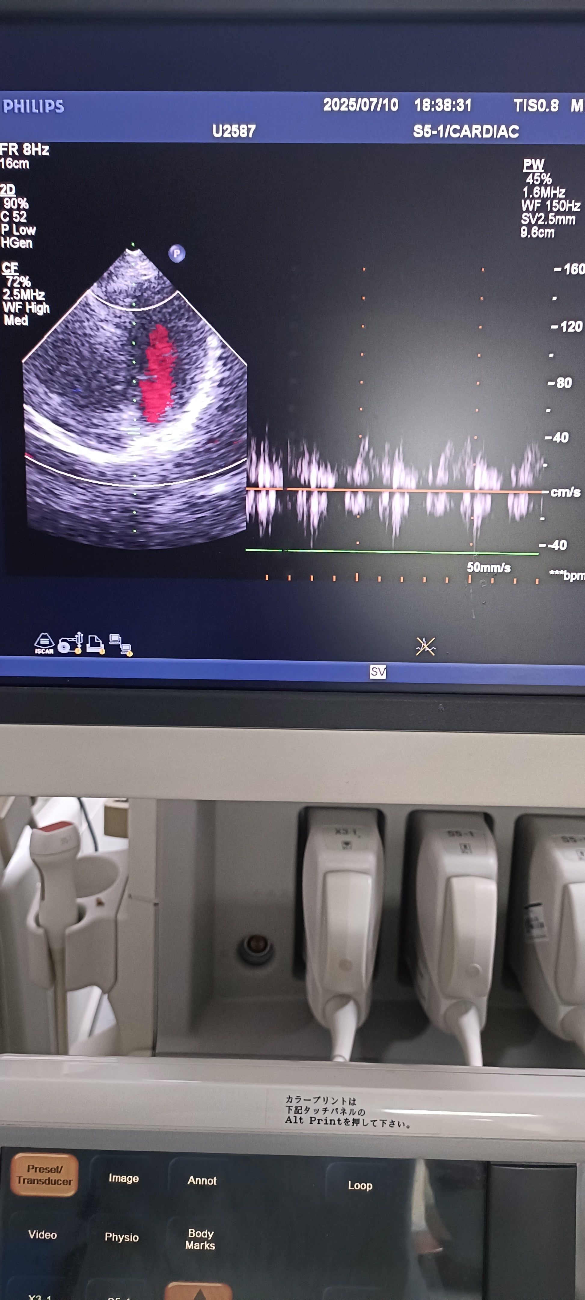 Philips s5-1 cardiac probe sn. 03FG2X checked dxb IS - Japan Medical Company LTD