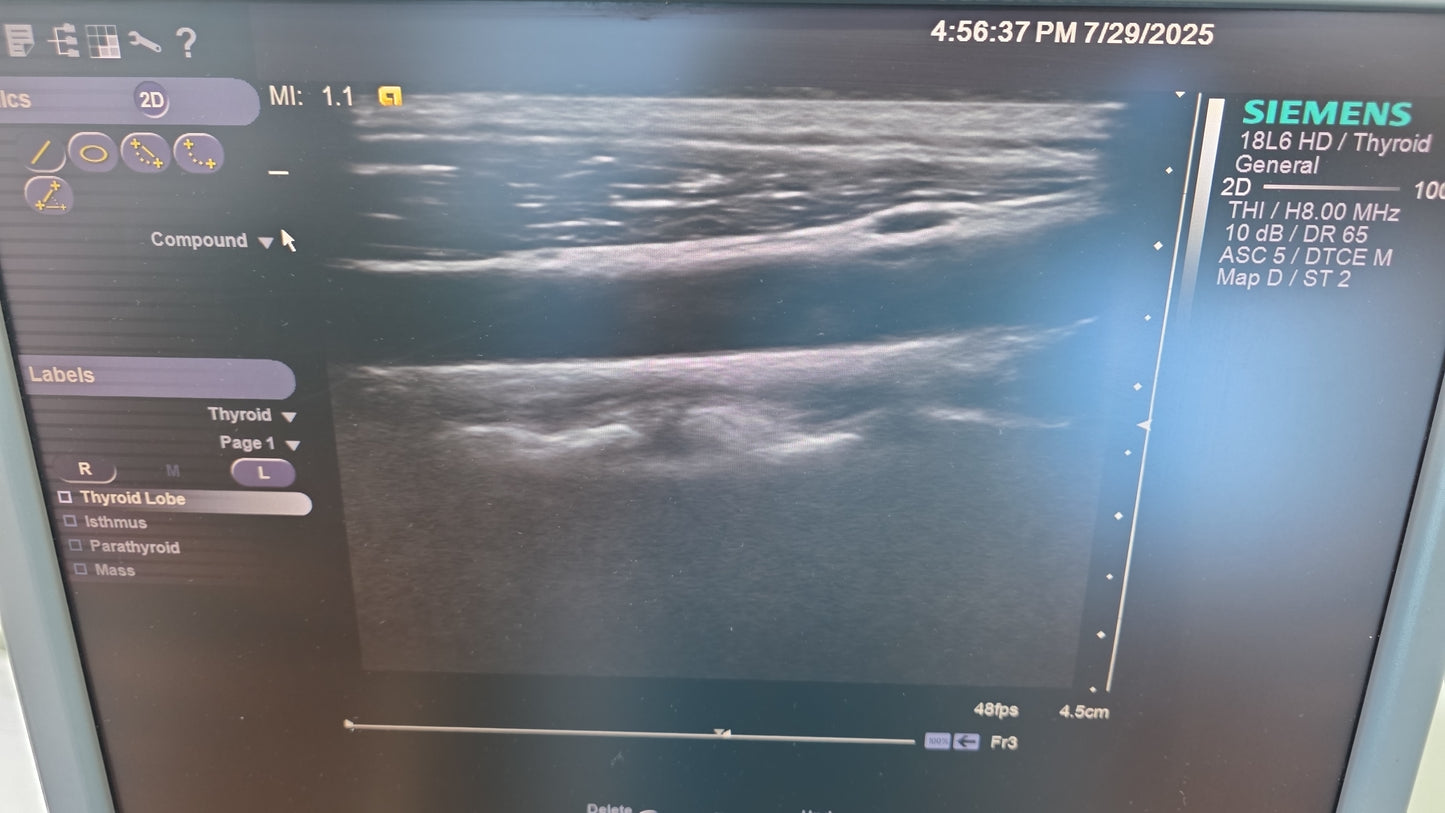 Siemens Acuson 18L6 HD Ultrasound Probe MFg: 2019 DXB checked ok