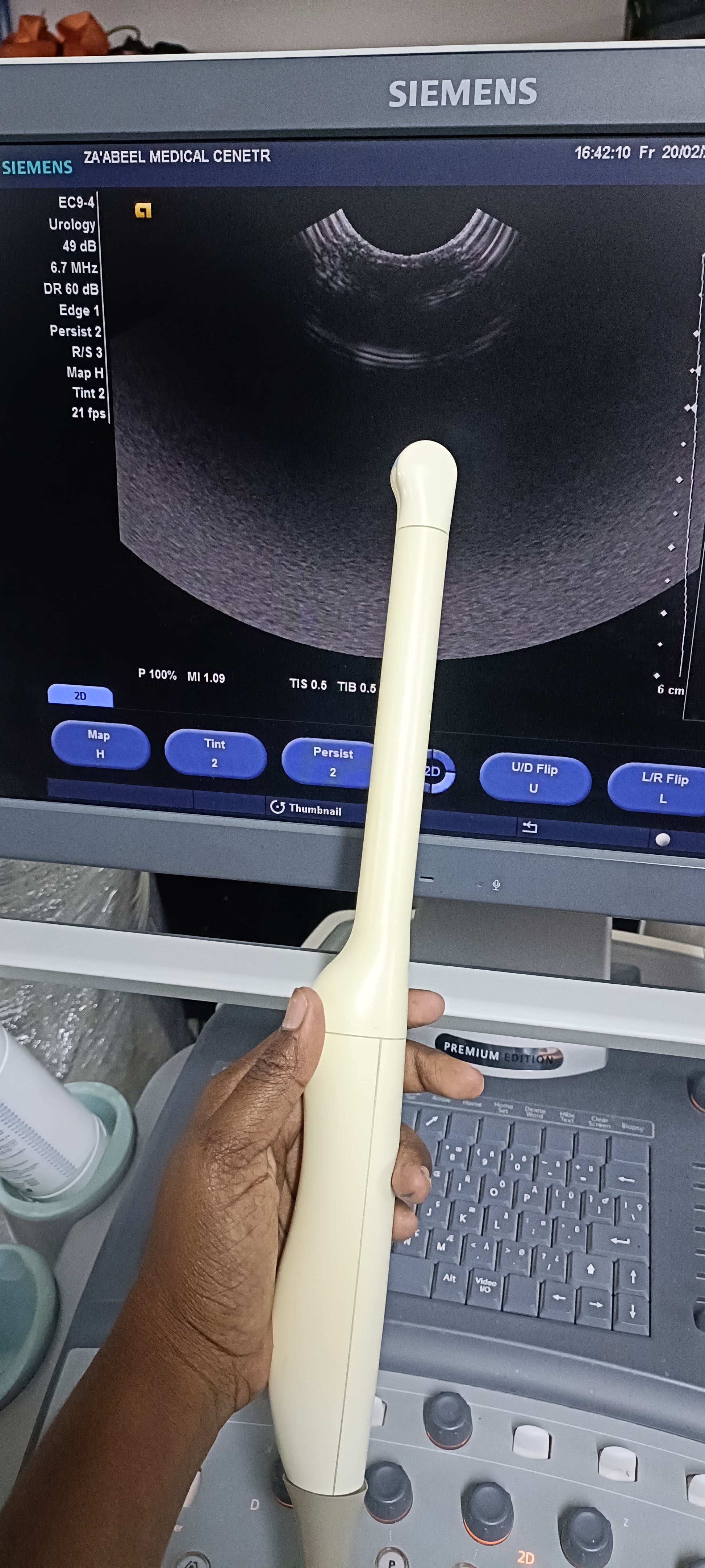 Siemens TVS PROBE SN. (21)64138010 CHECKED DXB IS - Japan Medical Company LTD