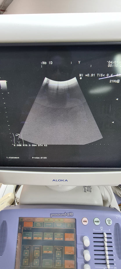 Aloka UST-9130  CONVEX checked Av. SN. X0061338