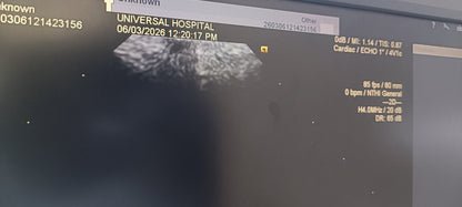 Siemens cardiac probe sn. (21)71912056 moy. 2017 checked dxb IS (MW) - Japan Medical Company LTD