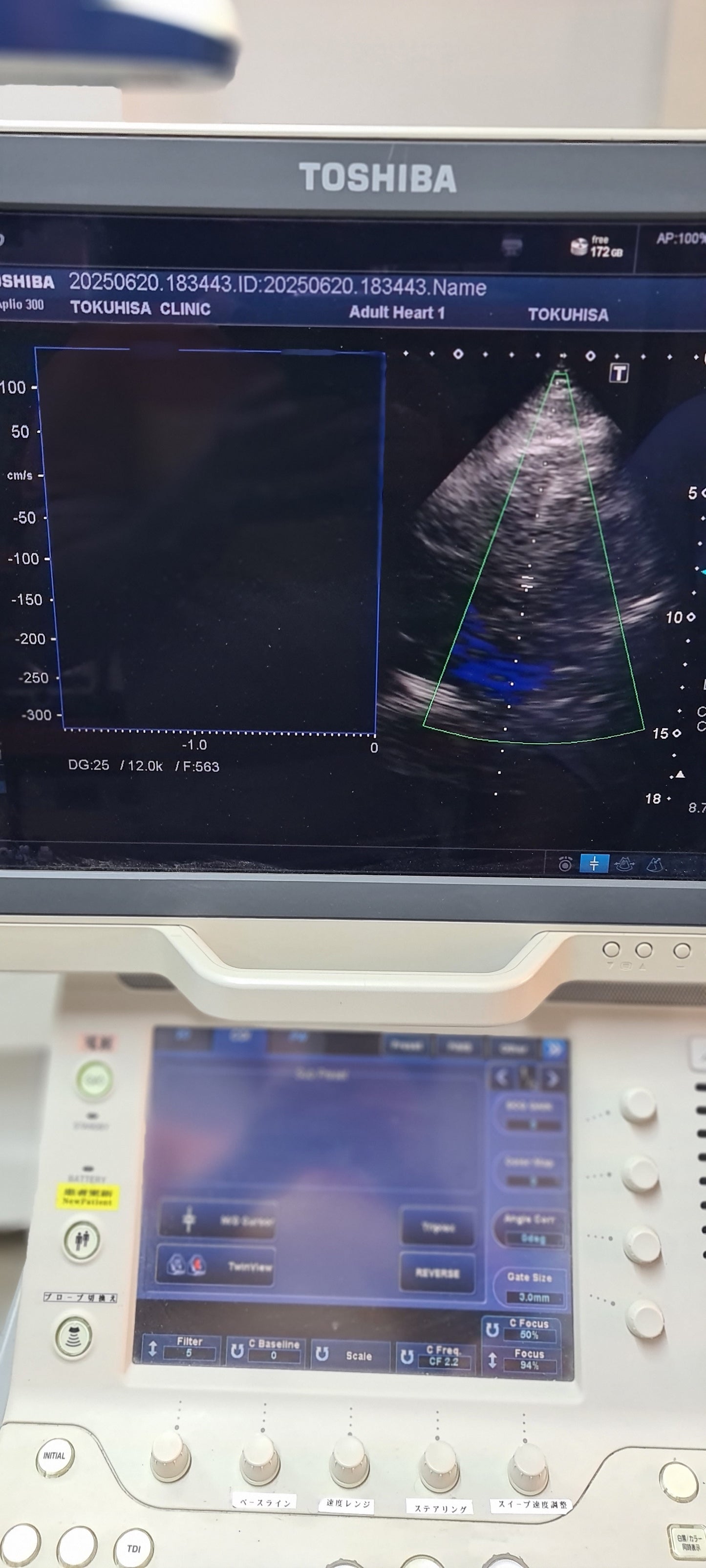 Toshiba PST-25BT Cardiac Probe  SN: TDA12X4263 Dxb