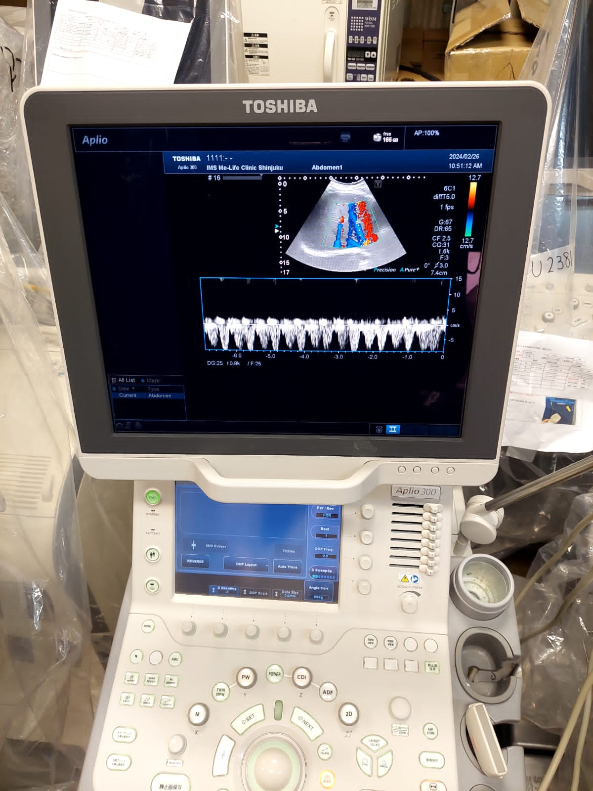 Toshiba Aplio 300 with convex linear probes. ( PVT-375BT, PLT-805AT) - Japan Medical Company LTD