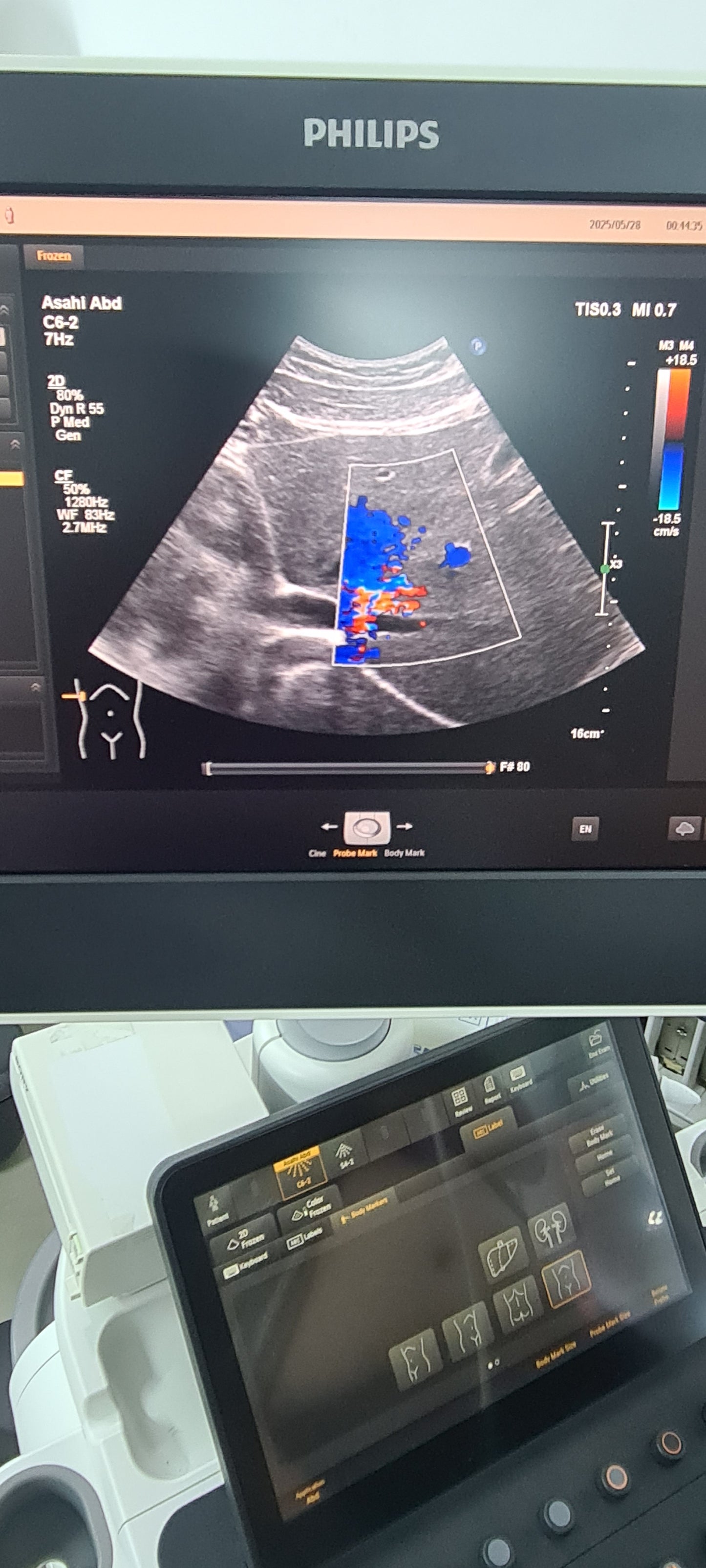 Philips C6-2 Convex probe SN: B16QFF checked DXB