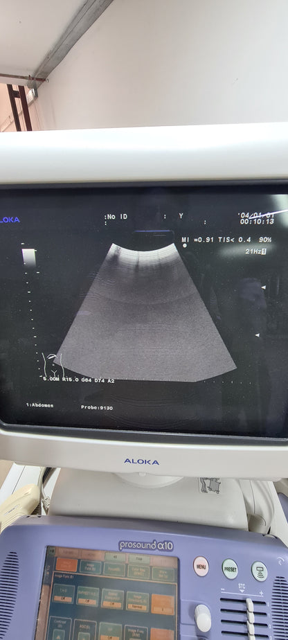 Aloka UST-9130  CONVEX checked Av. SN. X0061338