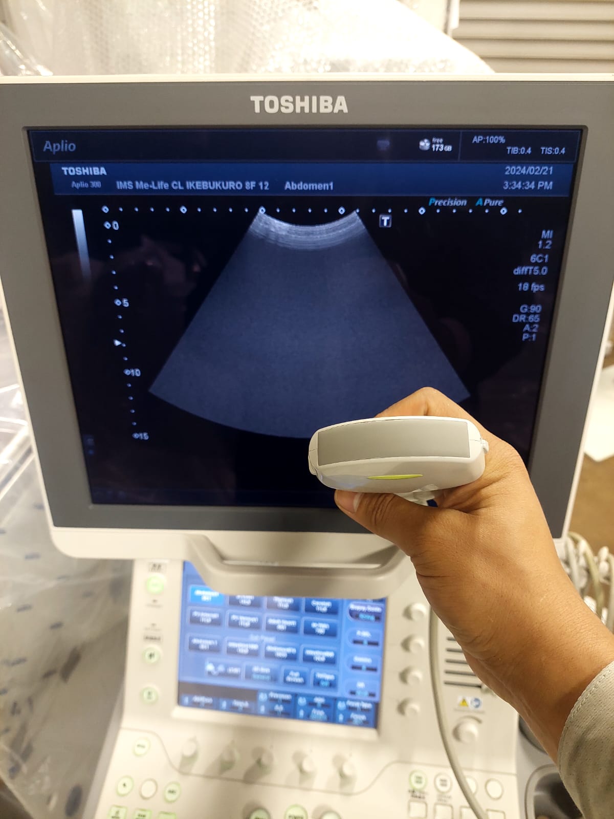 Toshiba Aplio 300 with convex(PVT-375BT), PLT(704AT), PLT(805AT) probes. - Japan Medical Company LTD