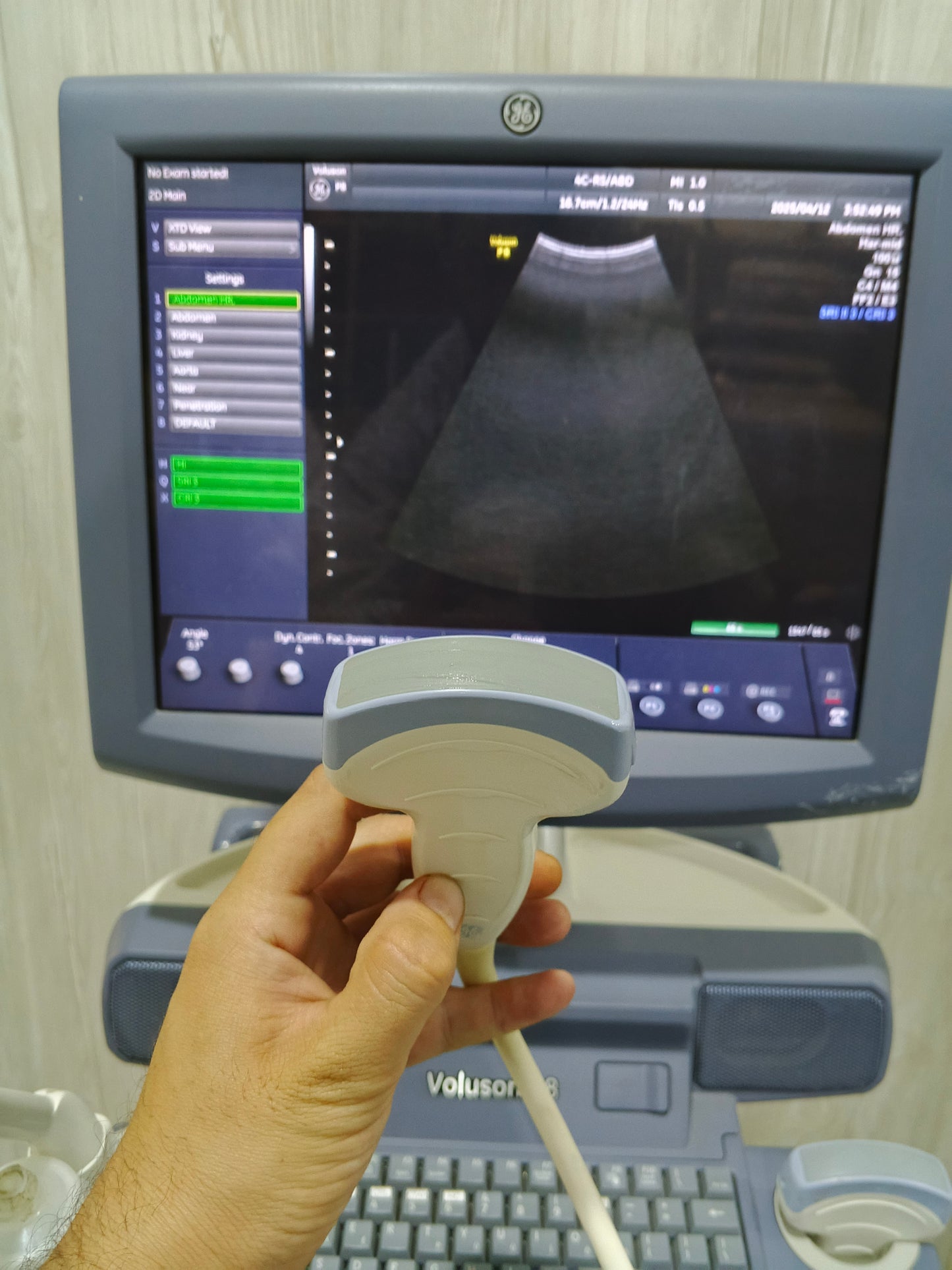 ...Ge voluson p8 convex probe