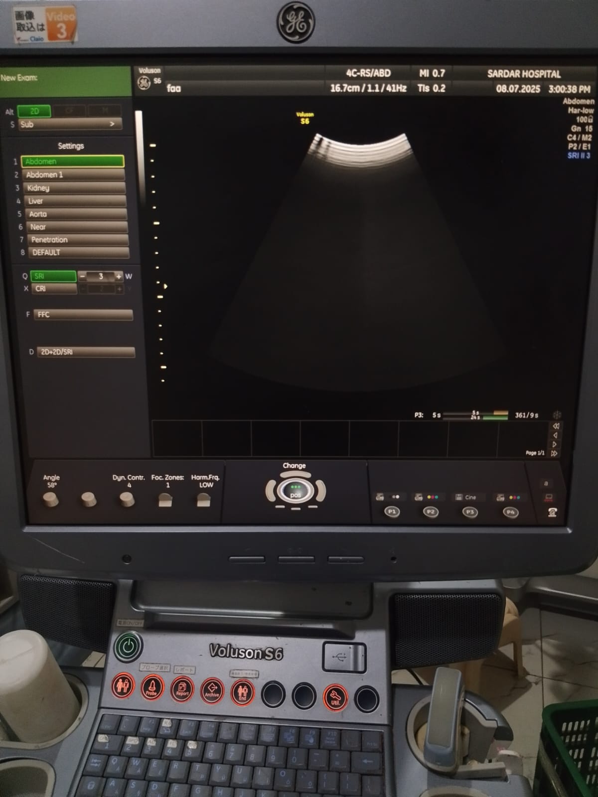 P..4c-Rs convex probe (2)