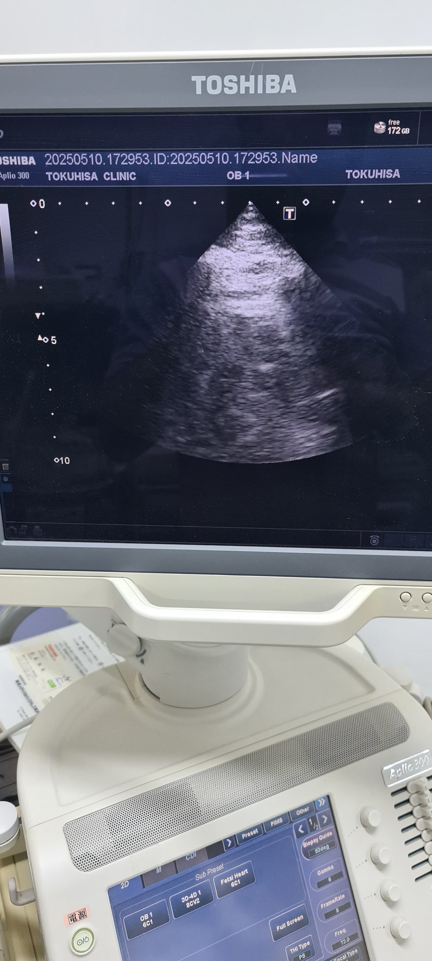 Toshiba 5S1 cardiac Prob SN: TDA1324614 checked DXB