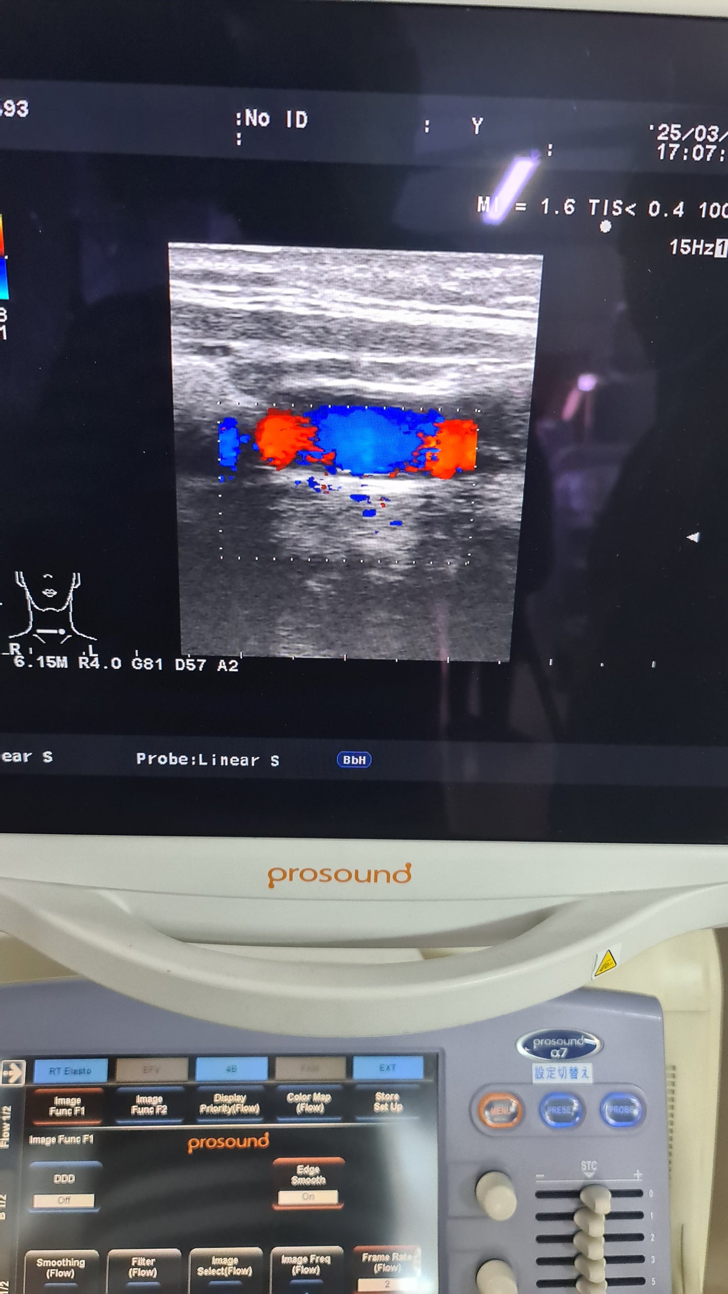 Aloka UST-5412 liner prob SN. M02414 checked