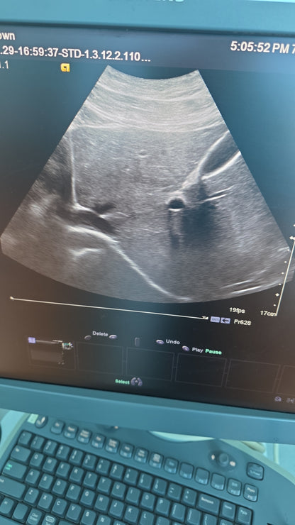 Siemens Acuson 6C2 Ultrasound Probe MFg: 2011 DXB checked ok