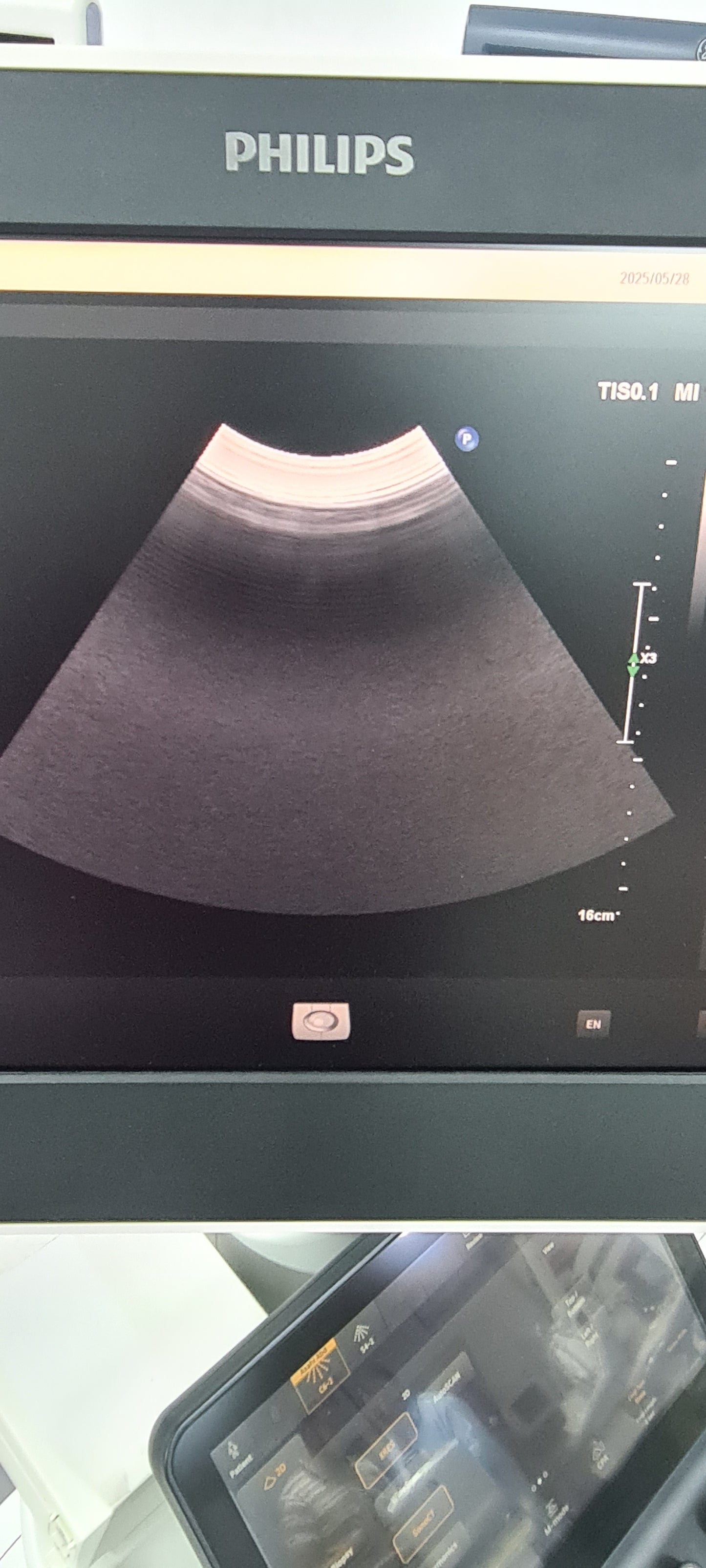 Philips C6-2 Convex probe SN: B16QFF checked DXB