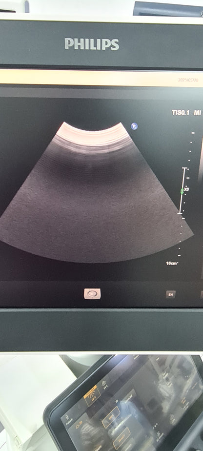 Philips C6-2 Convex probe SN: B16QFF checked DXB