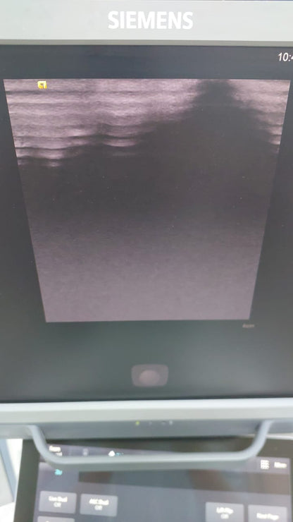 Siemens 9L4 Multi-D Linear probe, mfg : 2015 condition is not good