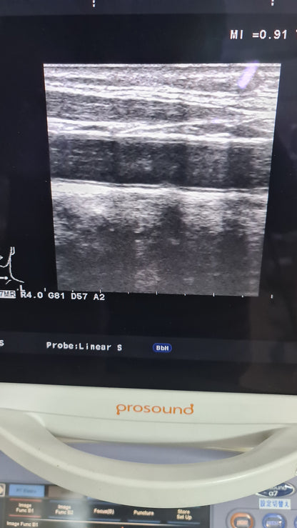 Aloka UST-5412 liner prob SN. M02414 checked