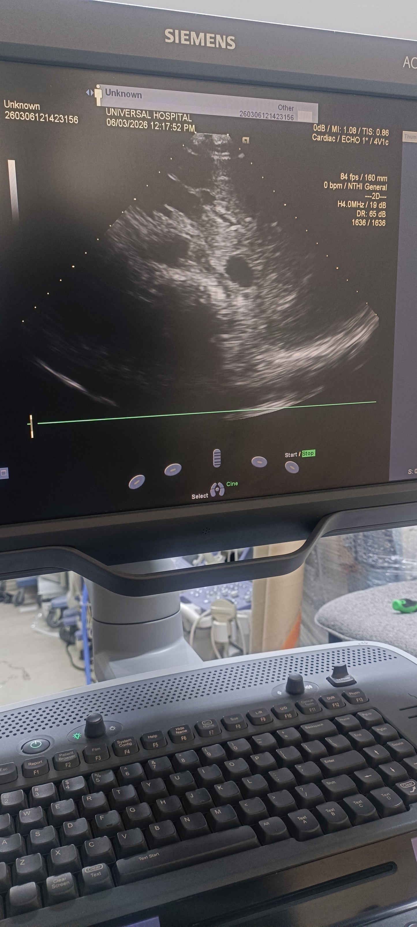 Siemens cardiac probe sn. (21)71912056 moy. 2017 checked dxb IS (MW) - Japan Medical Company LTD
