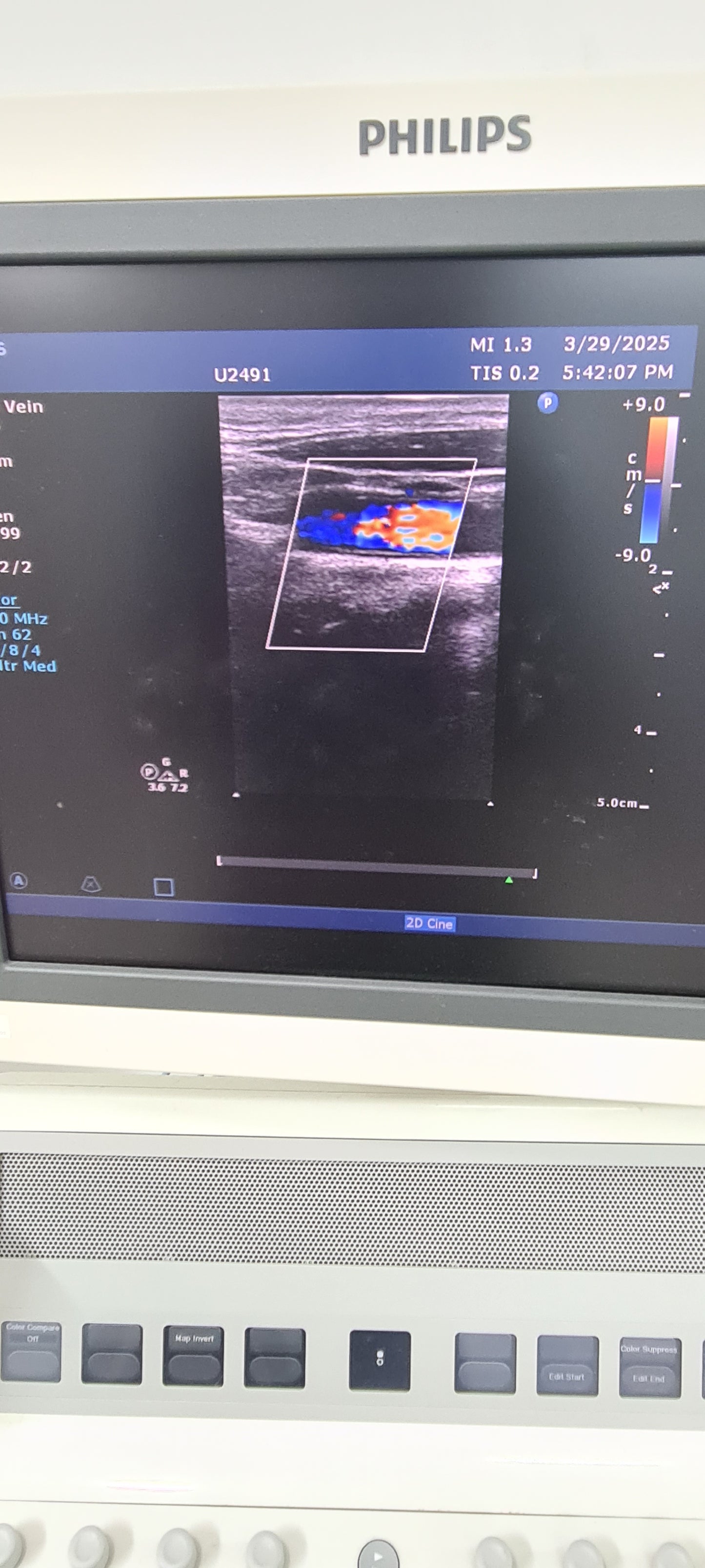 Philips L12-3 prob checked Ultrasound Transducer SN.2PFNQ PN. 453561182101