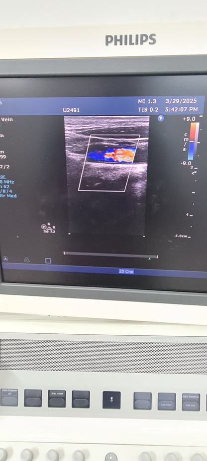 Philips L12-3 prob checked Ultrasound Transducer SN.2PFNQ PN. 453561182101