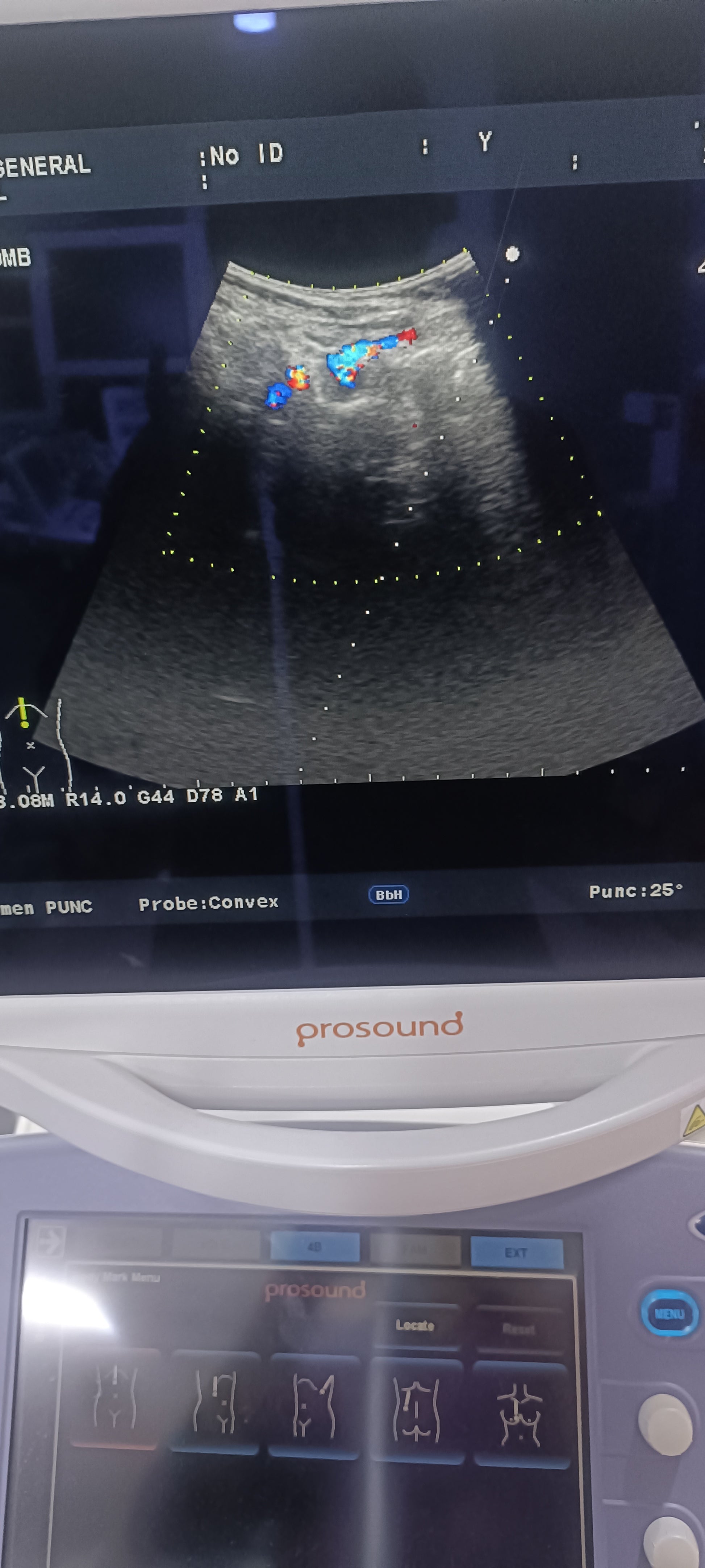 Aloka UST-9130 convex probe sn. X0003700 checked dxb - Japan Medical Company LTD
