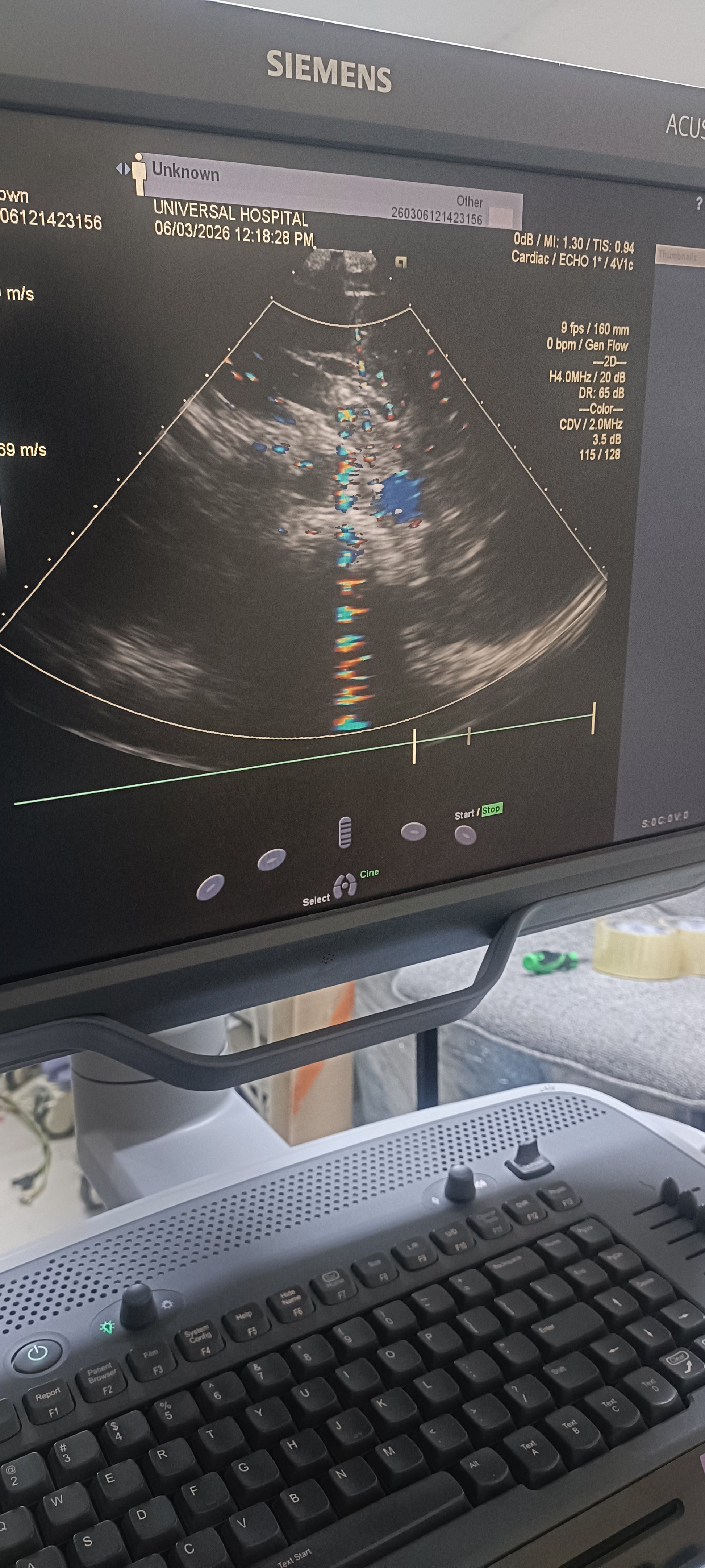 Siemens cardiac probe sn. (21)71912056 moy. 2017 checked dxb IS (MW) - Japan Medical Company LTD