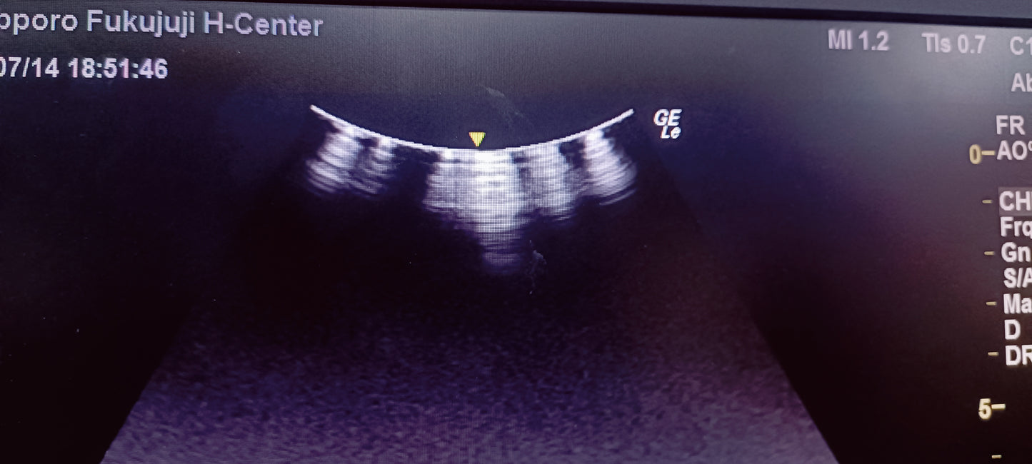 C1-5 RS Av (17) CHECKED NOT OK DXB