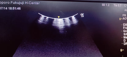 C1-5 RS Av (17) CHECKED NOT OK DXB