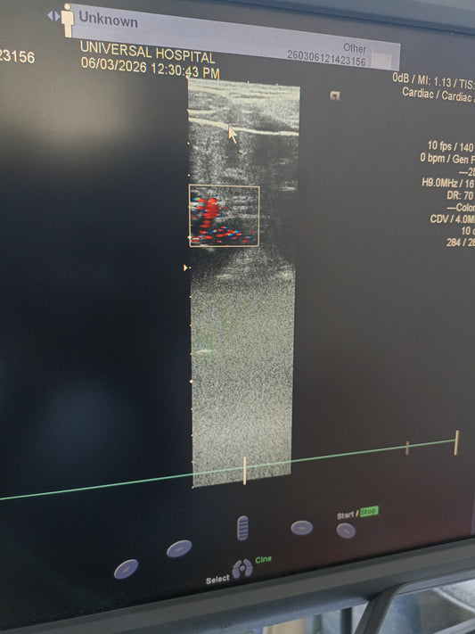 Siemens linear probe sn. (21)80452028 moy. 2018 checked dxb IS (MW) - Japan Medical Company LTD