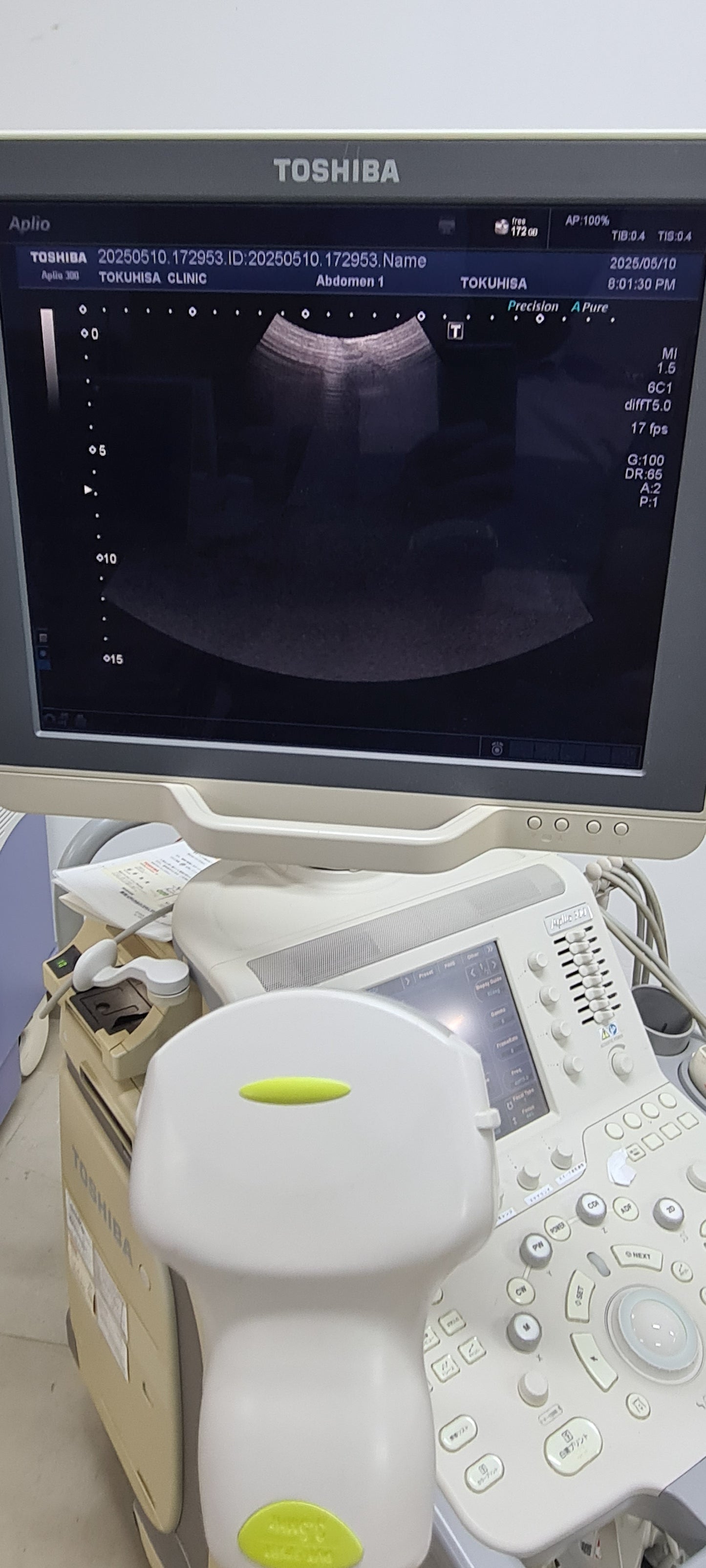 Toshiba 6C1 Convex Prob  checked SN: FDE2134652 dxb