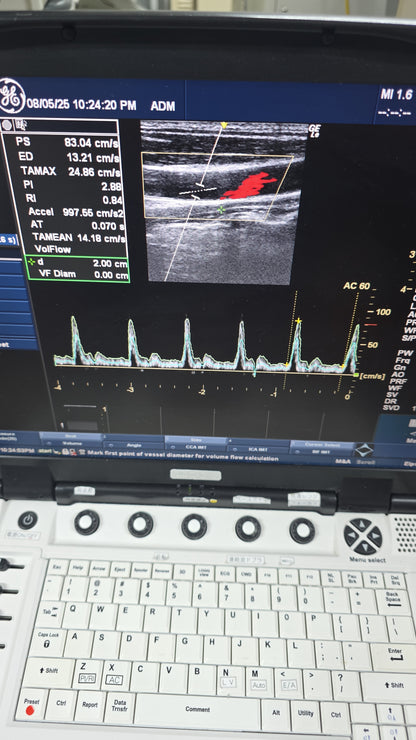 GE 12L-RS Linear probe YOM:2006 checked ok dxb