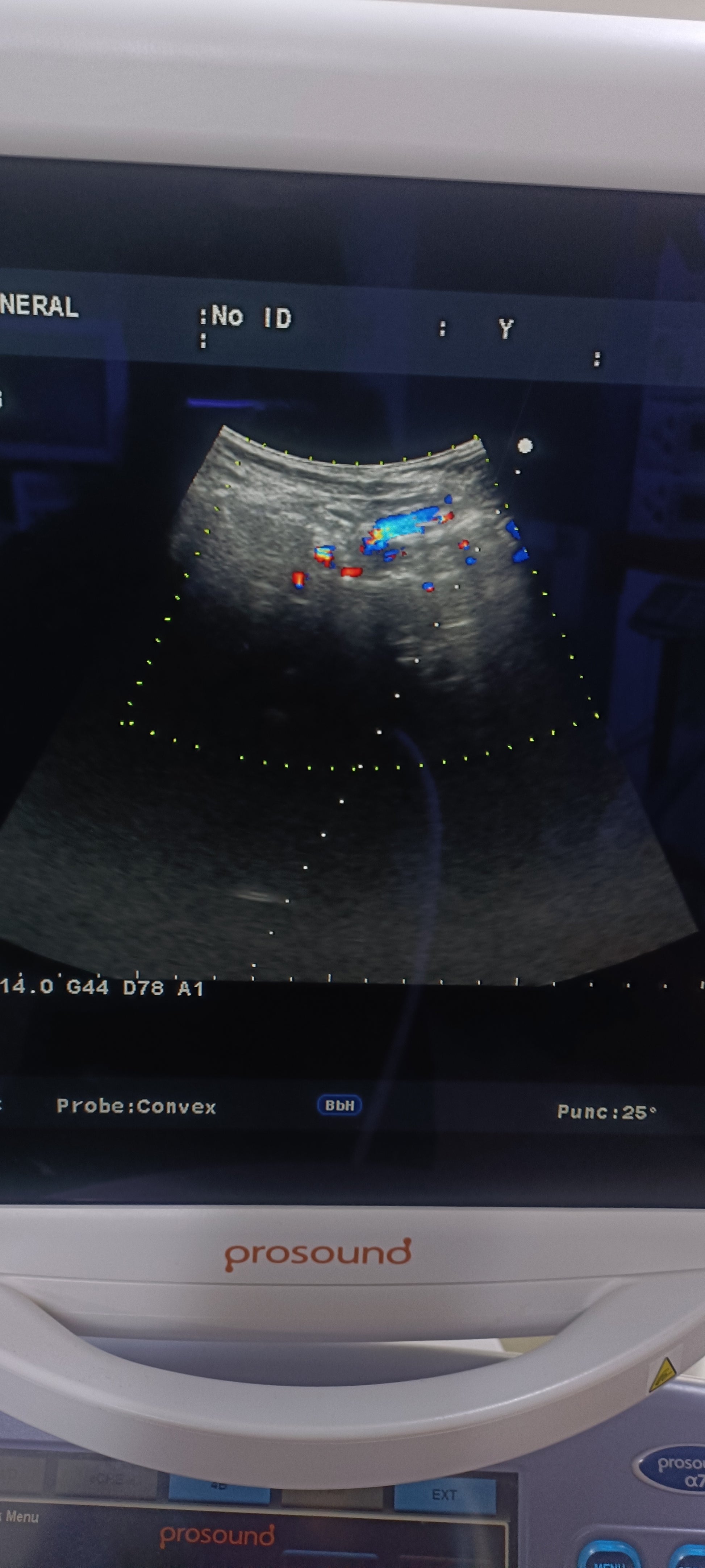 Aloka UST-9130 convex probe sn. X0003700 checked dxb - Japan Medical Company LTD