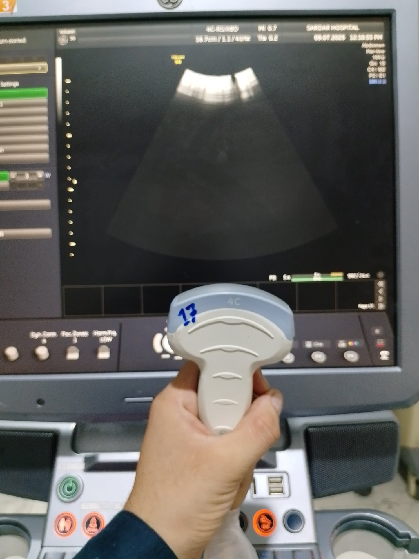 P..4c-Rs convex probe (17)