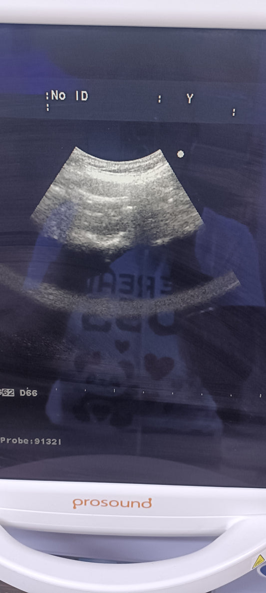 Aloka ust-91321 sn. 202A7424 (MW) checked dxb IS - Japan Medical Company LTD