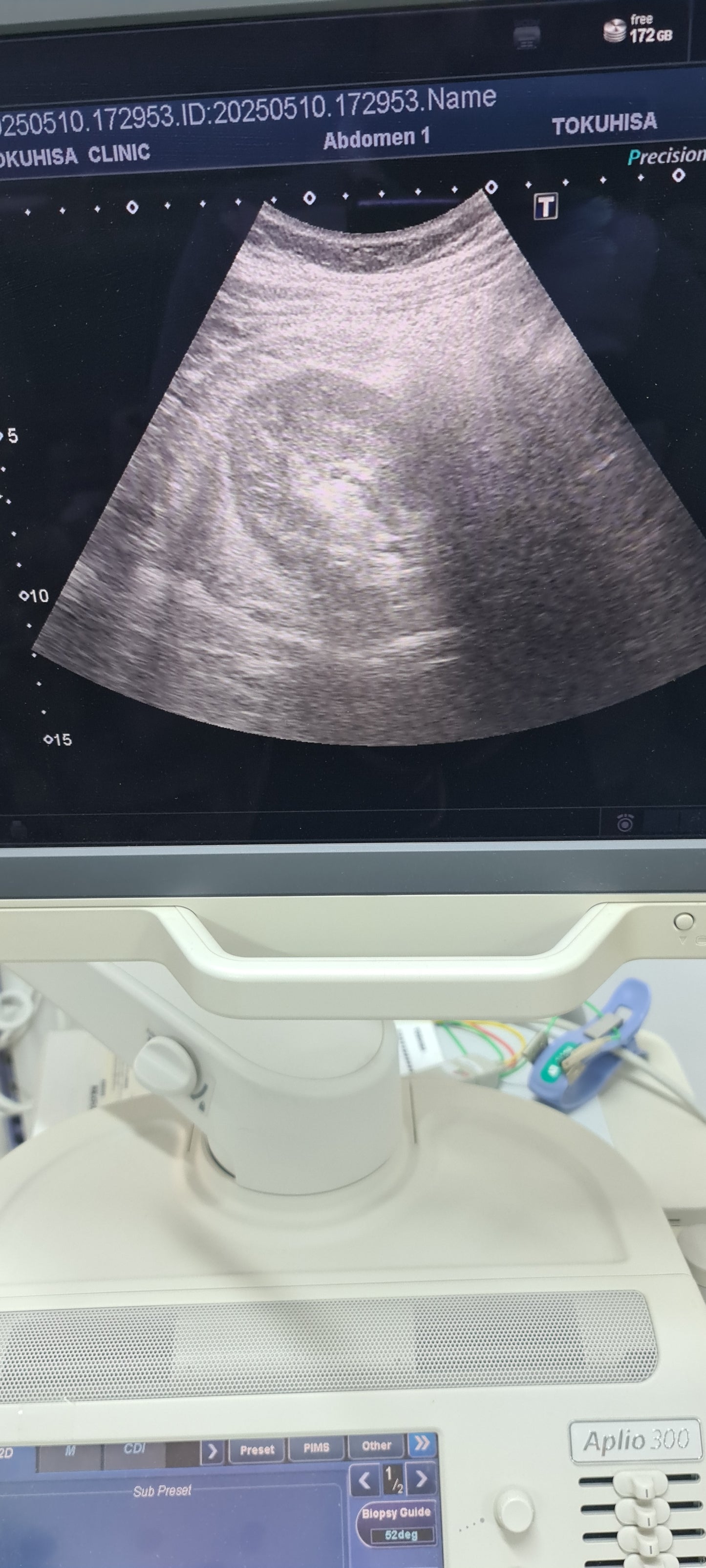 Toshiba PVT-375BT 6C1 Convex Prob Checked SN: FDA1235741 dxb