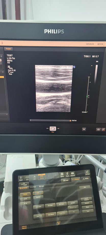 Philips L15-7io Hockey stick Prob  SN: B0K8N4 checked DXB