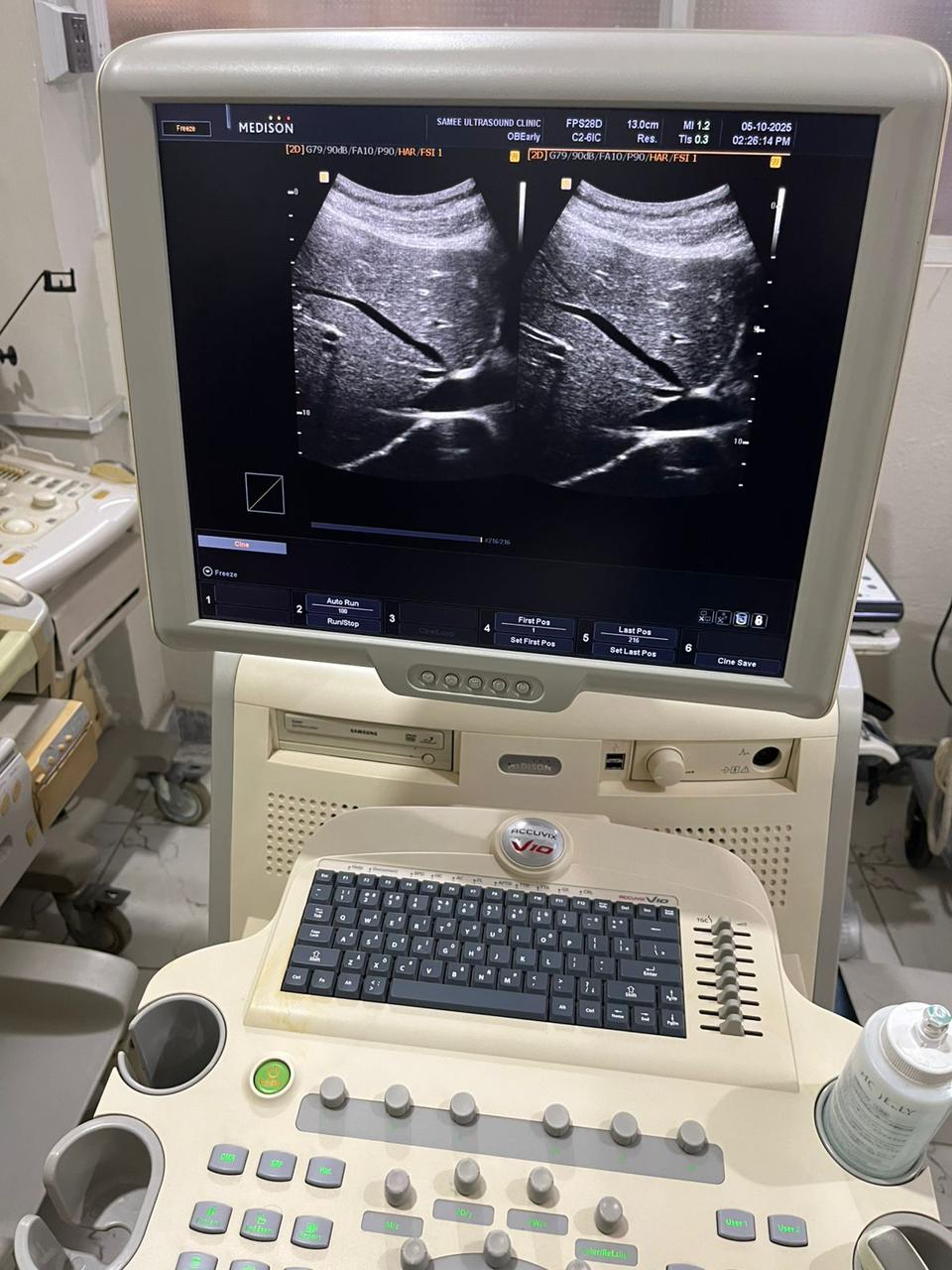 Samsung medison c2-6ic sn. B17914310029082 checked dxb