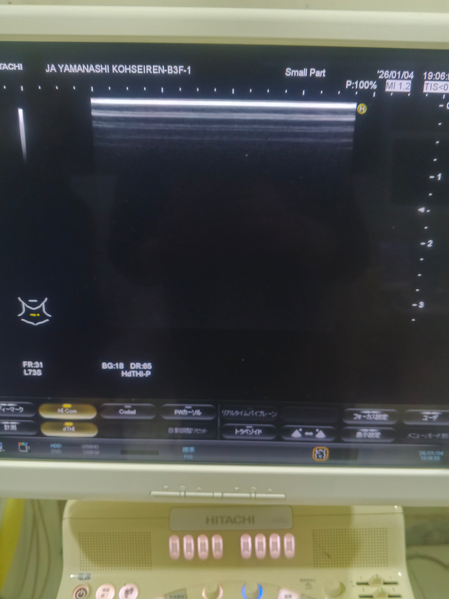 Hitachi avius Linear probe