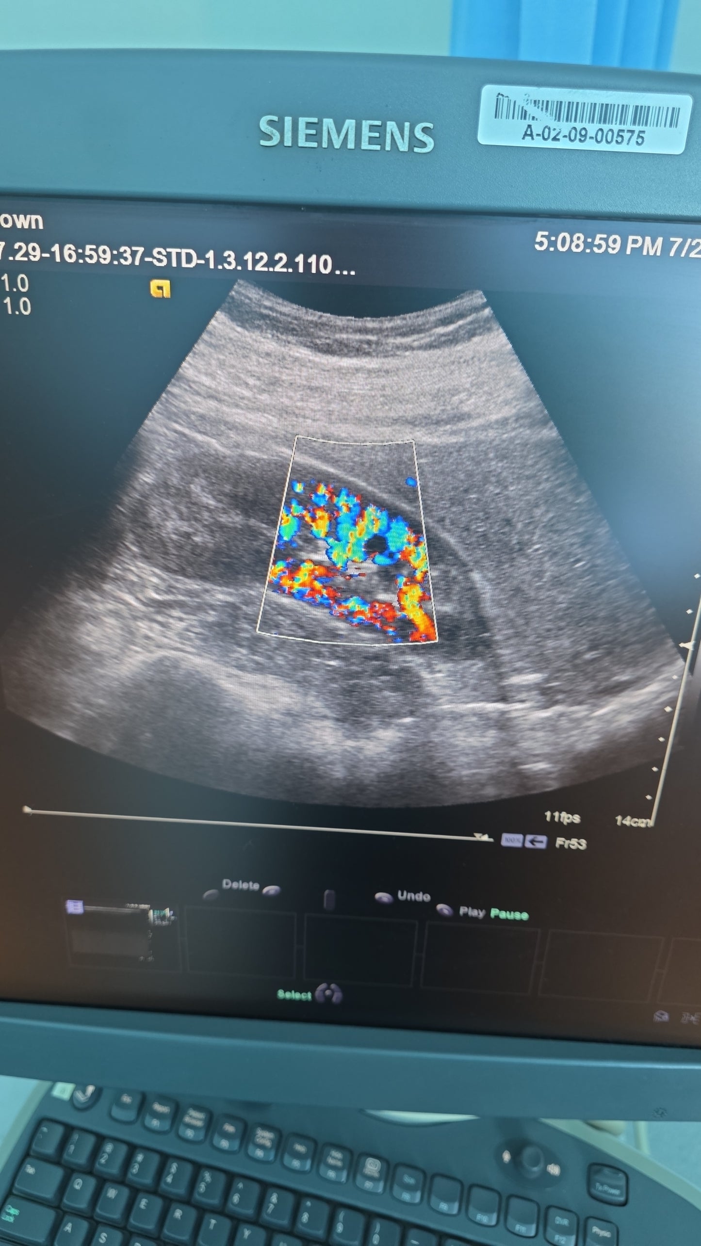 Siemens Acuson 6C2 Ultrasound Probe MFg: 2011 DXB checked ok