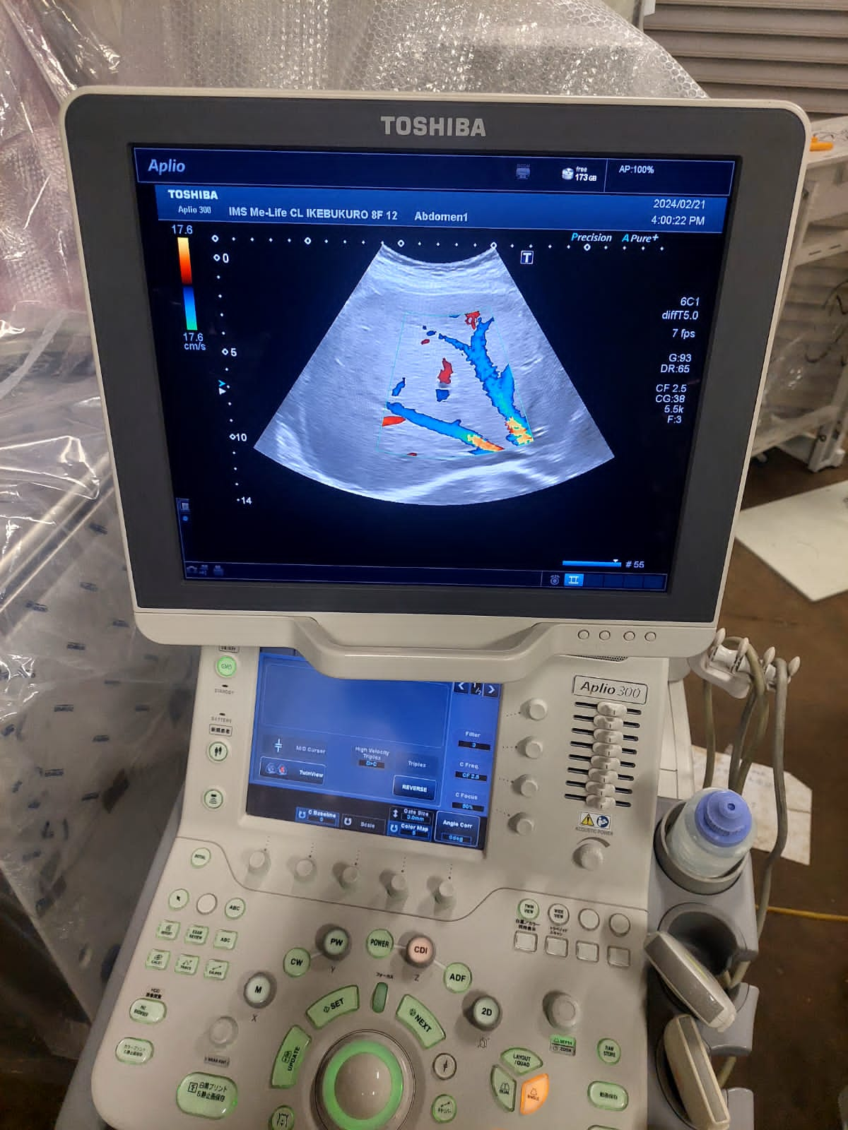 Toshiba Aplio 300 with convex(PVT-375BT), PLT(704AT), PLT(805AT) probes. - Japan Medical Company LTD