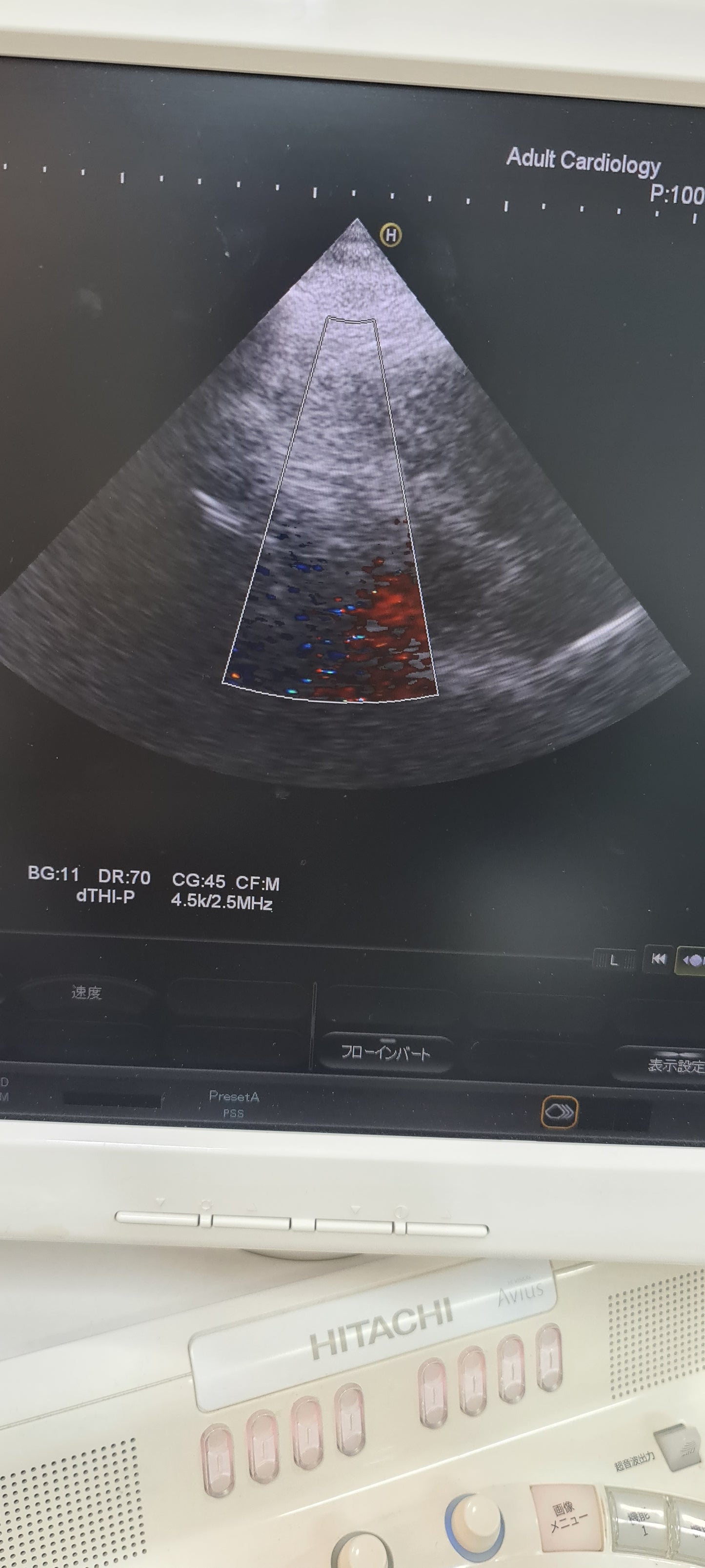 ..Hitachi EUP-S50A cardiac probe Checked DXB