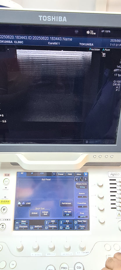 Toshiba PLT-1005BT Linear Probe SN: FSB16X4151 Dxb checked