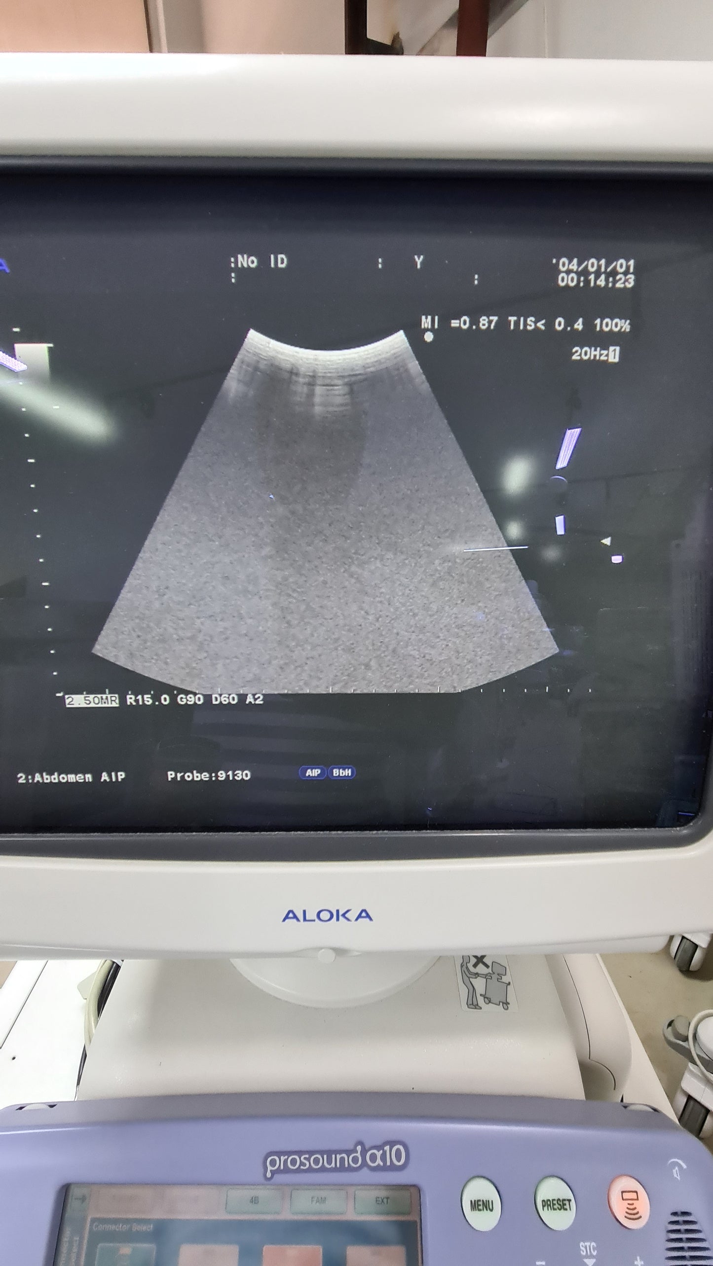 ..Aloka UST-9130 convex probe (S.N: M02904) checked DXB